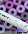 Chile propone trasladar enfermos con coronavirus a Argentina